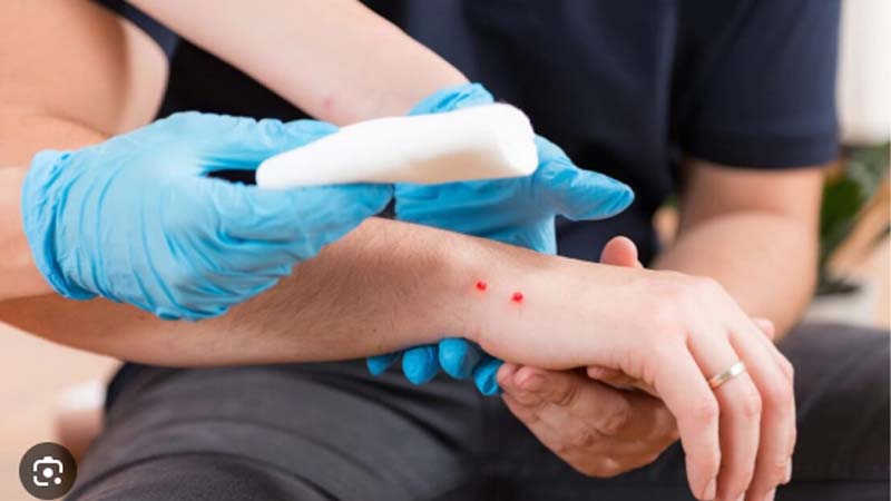 Nằm Mơ Thấy Rắn Cắn Vào Tay Là Điềm Gì? Giải Mã Chi Tiết 3 Mo thay ran doc can vao tay