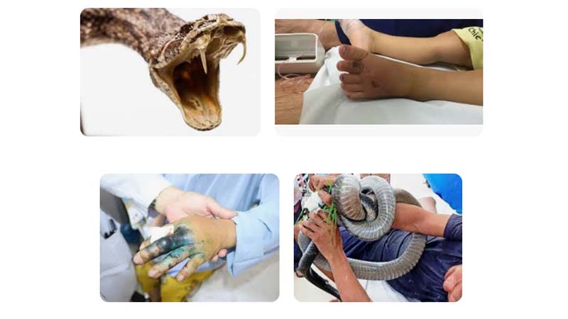 Nằm Mơ Thấy Rắn Cắn Đánh Số Gì? Giải Mã Chi Tiết Giấc Mơ 5 Nam mo thay ran can vao vi tri khac