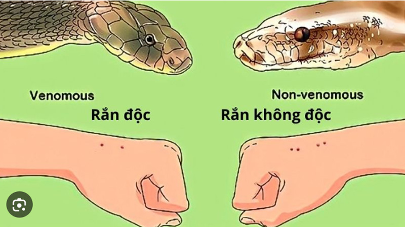 Nằm Mơ Thấy Rắn Cắn Vào Tay Đánh Số Gì? Giải Mã Chi Tiết 5 Vi tri ran can tren tay